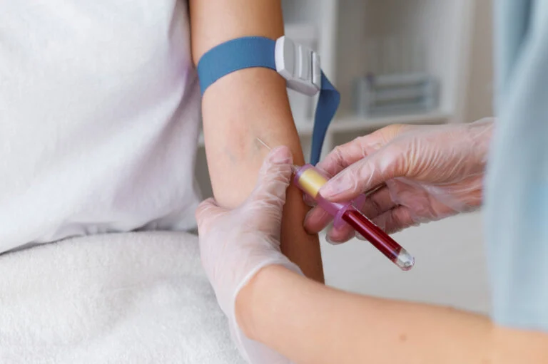 Αιματολογικό Check Up από 32€